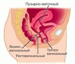Анатомия женского таза